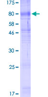SLC40A1 / Ferroportin-1 Protein - 12.5% SDS-PAGE of human SLC40A1 stained with Coomassie Blue