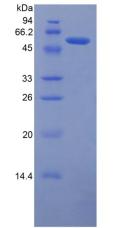 SLC40A1 / Ferroportin-1 Protein - Recombinant Ferroportin By SDS-PAGE