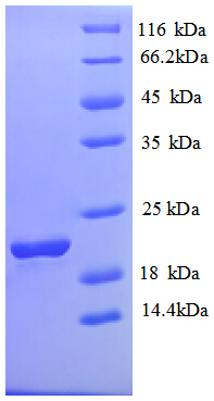 SLC41A2 Protein