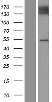 SLC41A3 Protein - Western validation with an anti-DDK antibody * L: Control HEK293 lysate R: Over-expression lysate