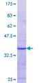 SLC43A1 Protein - 12.5% SDS-PAGE Stained with Coomassie Blue.