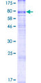 SLC43A2 Protein - 12.5% SDS-PAGE of human SLC43A2 stained with Coomassie Blue