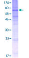 SLC43A3 Protein - 12.5% SDS-PAGE of human SLC43A3 stained with Coomassie Blue