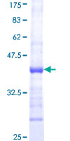 SLC44A1 / CD92 Protein - 12.5% SDS-PAGE Stained with Coomassie Blue.