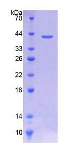 SLC44A1 / CD92 Protein - Recombinant  Choline Transporter Like Protein 1 By SDS-PAGE