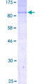 SLC44A2 / CTL2 Protein - 12.5% SDS-PAGE of human SLC44A2 stained with Coomassie Blue