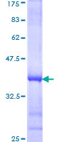 SLC44A2 / CTL2 Protein - 12.5% SDS-PAGE Stained with Coomassie Blue.