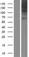 SLC44A4 Protein - Western validation with an anti-DDK antibody * L: Control HEK293 lysate R: Over-expression lysate