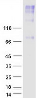 SLC44A4 Protein - Purified recombinant protein SLC44A4 was analyzed by SDS-PAGE gel and Coomassie Blue Staining