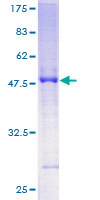 SLC45A2 Protein - 12.5% SDS-PAGE of human MATP stained with Coomassie Blue