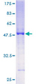 SLC45A2 Protein - 12.5% SDS-PAGE of human MATP stained with Coomassie Blue