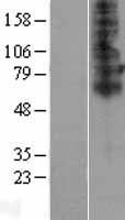 SLC46A2 Protein - Western validation with an anti-DDK antibody * L: Control HEK293 lysate R: Over-expression lysate