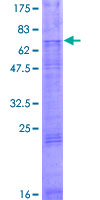 SLC46A2 Protein - 12.5% SDS-PAGE of human SLC46A2 stained with Coomassie Blue
