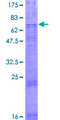 SLC46A2 Protein - 12.5% SDS-PAGE of human SLC46A2 stained with Coomassie Blue