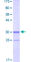 SLC46A2 Protein - 12.5% SDS-PAGE Stained with Coomassie Blue.