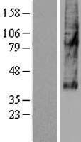 SLC46A3 Protein - Western validation with an anti-DDK antibody * L: Control HEK293 lysate R: Over-expression lysate