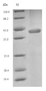 SLC4A1 / Band 3 / AE1 Protein - (Tris-Glycine gel) Discontinuous SDS-PAGE (reduced) with 5% enrichment gel and 15% separation gel.