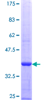 SLC4A1 / Band 3 / AE1 Protein - 12.5% SDS-PAGE Stained with Coomassie Blue.