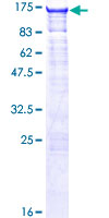 SLC4A1AP / Kanadaptin Protein - 12.5% SDS-PAGE of human SLC4A1AP stained with Coomassie Blue