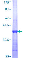 SLC4A1AP / Kanadaptin Protein - 12.5% SDS-PAGE Stained with Coomassie Blue.