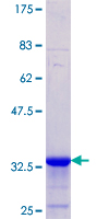 SLC4A2 / AE2 Protein - 12.5% SDS-PAGE Stained with Coomassie Blue.