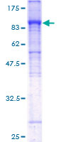SLC4A4 / NBC1 Protein - 12.5% SDS-PAGE of human SLC4A4 stained with Coomassie Blue