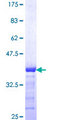 SLC4A4 / NBC1 Protein - 12.5% SDS-PAGE Stained with Coomassie Blue.