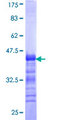 SLC4A8 / NBC Protein - 12.5% SDS-PAGE Stained with Coomassie Blue.
