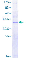 SLC50A1 / SCP Protein - 12.5% SDS-PAGE of human RAG1AP1 stained with Coomassie Blue