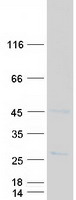SLC50A1 / SCP Protein - Purified recombinant protein SLC50A1 was analyzed by SDS-PAGE gel and Coomassie Blue Staining