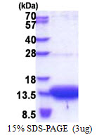 SLC51B / OSTBETA Protein
