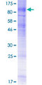 SLC5A1 / SGLT1 Protein - 12.5% SDS-PAGE of human SLC5A1 stained with Coomassie Blue