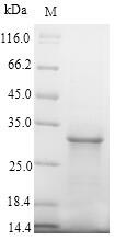 SLC5A2 / SGLT2 Protein - (Tris-Glycine gel) Discontinuous SDS-PAGE (reduced) with 5% enrichment gel and 15% separation gel.