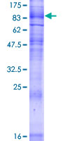 SLC5A2 / SGLT2 Protein - 12.5% SDS-PAGE of human SLC5A2 stained with Coomassie Blue