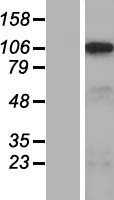 SLC5A3  Protein - Western validation with an anti-DDK antibody * L: Control HEK293 lysate R: Over-expression lysate
