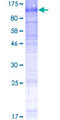 SLC5A3  Protein - 12.5% SDS-PAGE of human SLC5A3 stained with Coomassie Blue