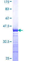 SLC5A3  Protein - 12.5% SDS-PAGE Stained with Coomassie Blue.