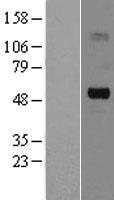 SLC5A7 / Choline Transporter Protein - Western validation with an anti-DDK antibody * L: Control HEK293 lysate R: Over-expression lysate