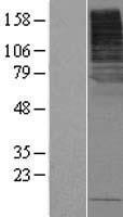 SLC5A8 / AIT Protein - Western validation with an anti-DDK antibody * L: Control HEK293 lysate R: Over-expression lysate