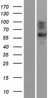 SLC6A1 / GAT-1 Protein - Western validation with an anti-DDK antibody * L: Control HEK293 lysate R: Over-expression lysate