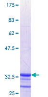 SLC6A11 / GAT-3 Protein - 12.5% SDS-PAGE Stained with Coomassie Blue.