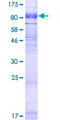 SLC6A16 Protein - 12.5% SDS-PAGE of human SLC6A16 stained with Coomassie Blue