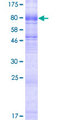 SLC6A19 Protein - 12.5% SDS-PAGE of human SLC6A19 stained with Coomassie Blue