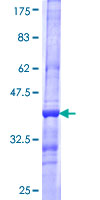 SLC6A19 Protein - 12.5% SDS-PAGE Stained with Coomassie Blue.