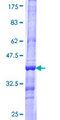 SLC6A19 Protein - 12.5% SDS-PAGE Stained with Coomassie Blue.