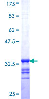 SLC6A20 Protein - 12.5% SDS-PAGE Stained with Coomassie Blue.