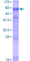 SLC6A3 / Dopamine Transporter Protein - 12.5% SDS-PAGE of human SLC6A3 stained with Coomassie Blue