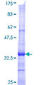 SLC6A3 / Dopamine Transporter Protein - 12.5% SDS-PAGE Stained with Coomassie Blue.