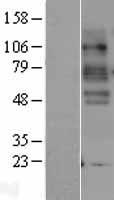 SLC6A4 / SERT Protein - Western validation with an anti-DDK antibody * L: Control HEK293 lysate R: Over-expression lysate