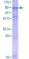 SLC6A4 / SERT Protein - 12.5% SDS-PAGE of human SLC6A4 stained with Coomassie Blue